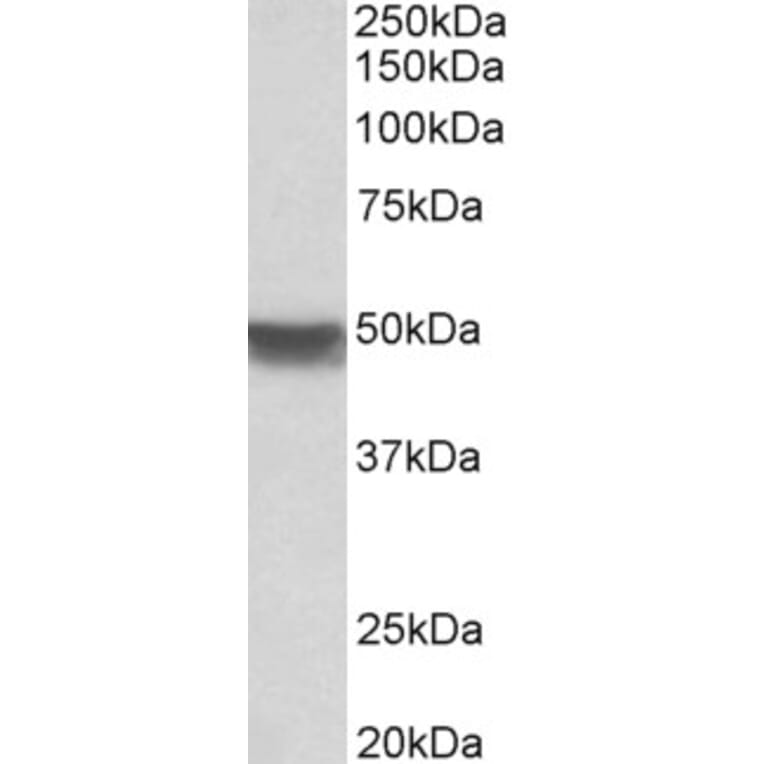 Western Blot - Anti-Cytokeratin 20 Antibody (A85071) - Antibodies.com