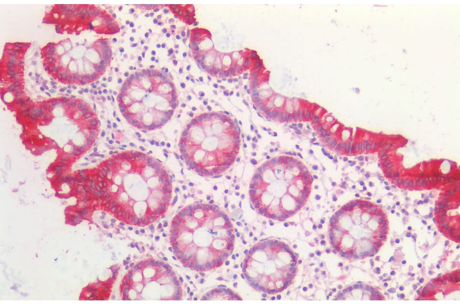 Immunohistochemistry - Anti-Cytokeratin 20 Antibody (A85071) - Antibodies.com