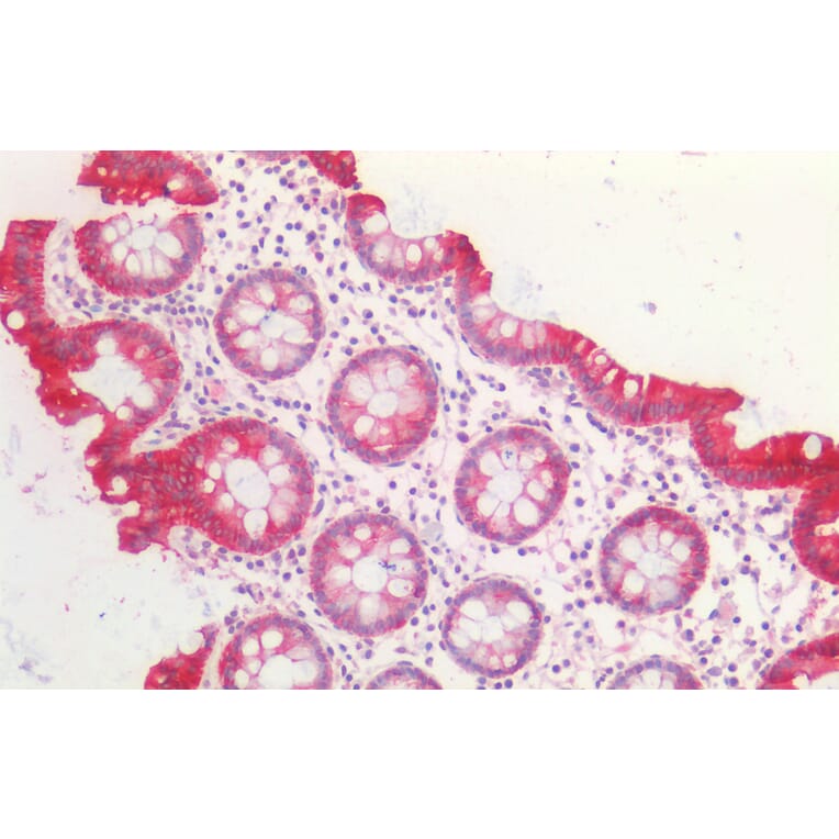 Immunohistochemistry - Anti-Cytokeratin 20 Antibody (A85071) - Antibodies.com