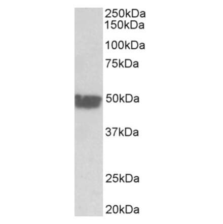 Western Blot - Anti-Cytokeratin 20 Antibody (A85073) - Antibodies.com