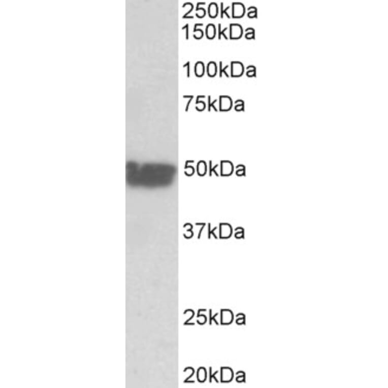 Western Blot - Anti-Cytokeratin 20 Antibody (A85073) - Antibodies.com