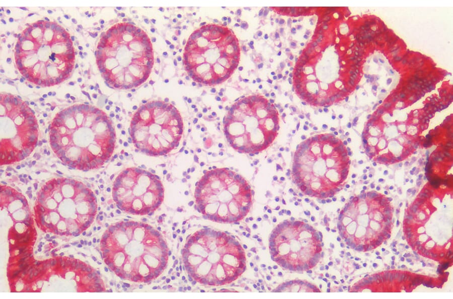Immunohistochemistry - Anti-Cytokeratin 20 Antibody (A85073) - Antibodies.com