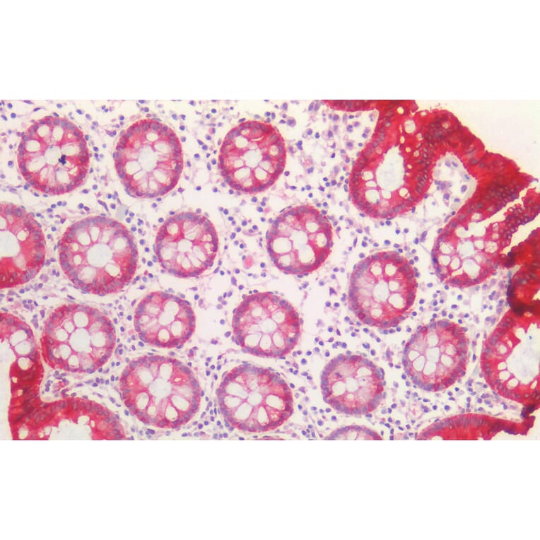 Immunohistochemistry - Anti-Cytokeratin 20 Antibody (A85073) - Antibodies.com