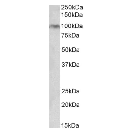 Western Blot - Anti-Aryl Hydrocarbon Receptor Antibody (A85074) - Antibodies.com