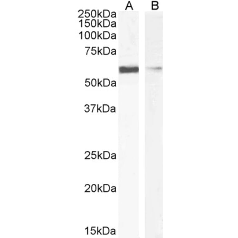 Western Blot - Anti-Insulin Degrading Enzyme/IDE (Long Isoform) Antibody (A85076) - Antibodies.com
