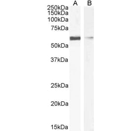 Western Blot - Anti-IDE Antibody (A85076) - Antibodies.com