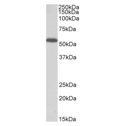 Western Blot - Anti-PCOLCE Antibody (A85078) - Antibodies.com