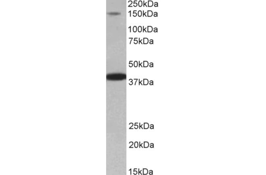 Western Blot - Anti-IRS4 Antibody (A85080) - Antibodies.com