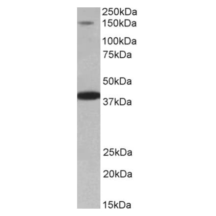 Western Blot - Anti-IRS4 Antibody (A85080) - Antibodies.com