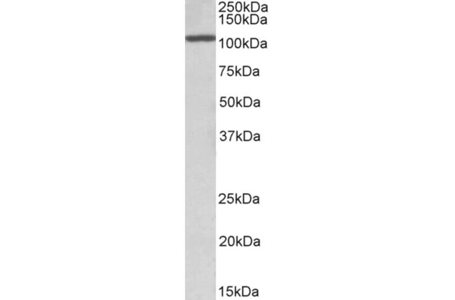 Western Blot - Anti-CEBPZ Antibody (A85082) - Antibodies.com