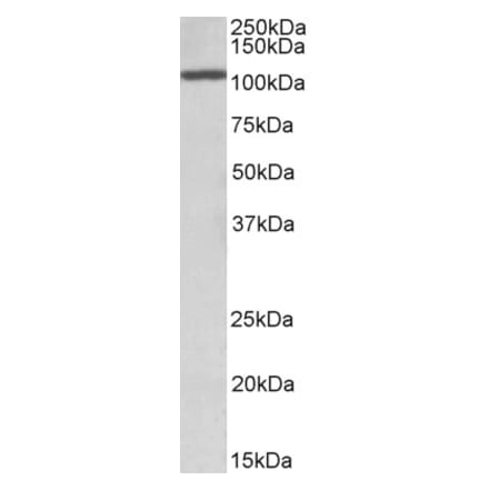 Western Blot - Anti-CEBPZ Antibody (A85082) - Antibodies.com