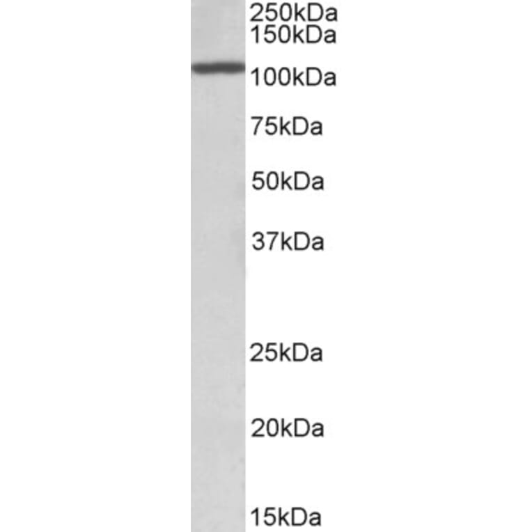 Western Blot - Anti-CEBPZ Antibody (A85082) - Antibodies.com