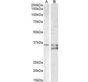 Western Blot - Anti-SGTA Antibody (A85083) - Antibodies.com
