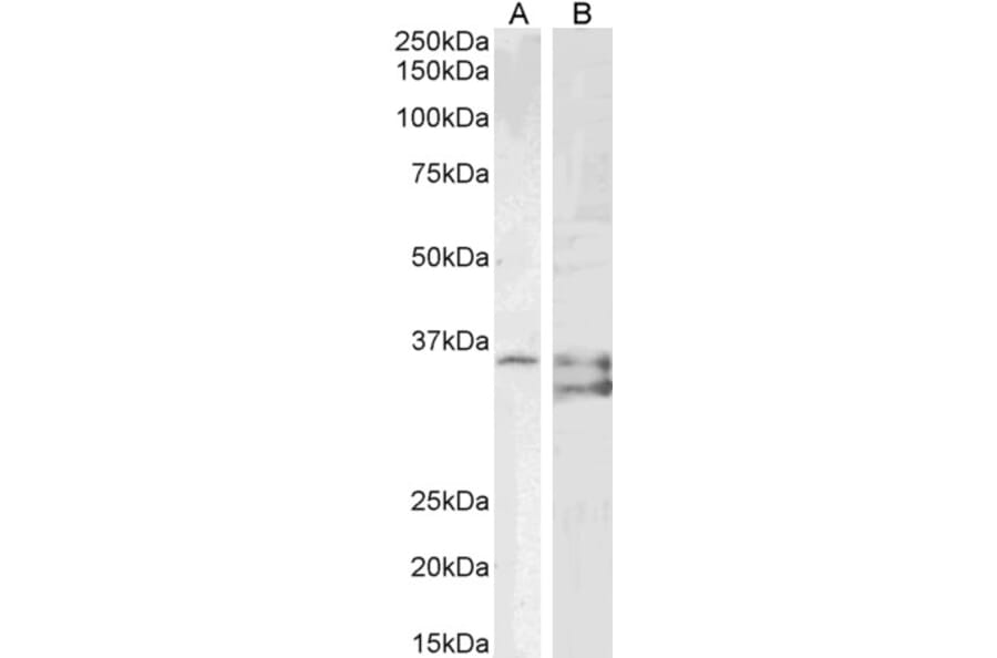 Western Blot - Anti-SGTA Antibody (A85083) - Antibodies.com