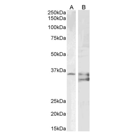 Western Blot - Anti-SGTA Antibody (A85083) - Antibodies.com