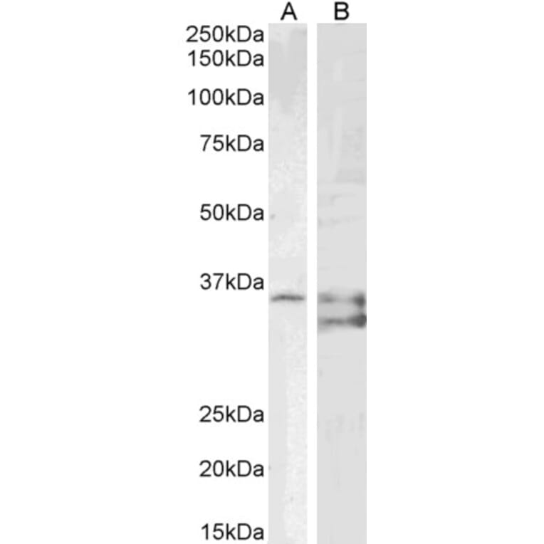 Western Blot - Anti-SGTA Antibody (A85083) - Antibodies.com
