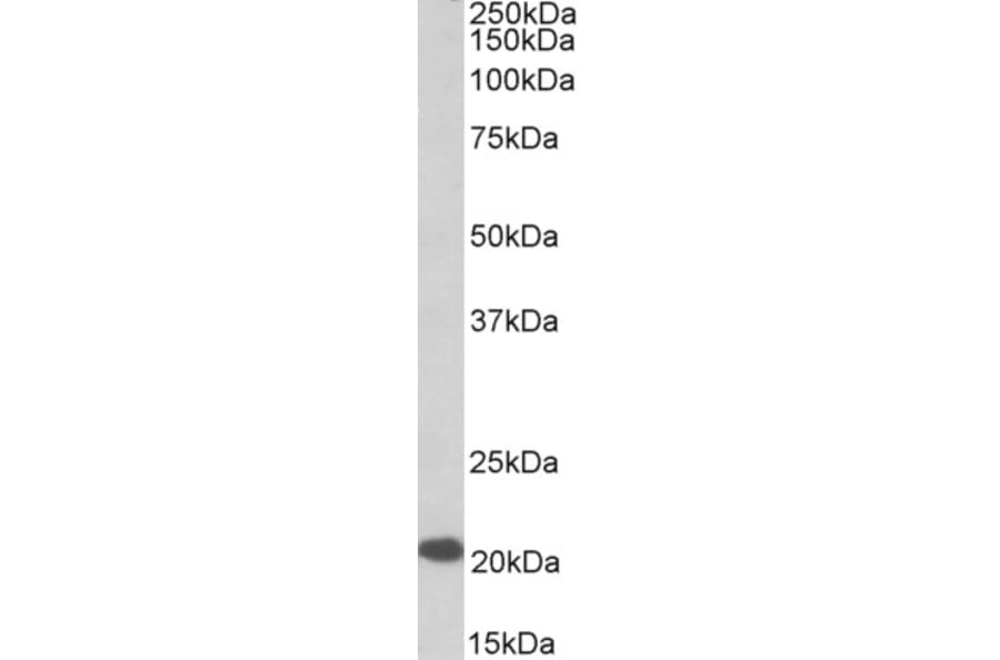Western Blot - Anti-CSP Antibody (A85084) - Antibodies.com