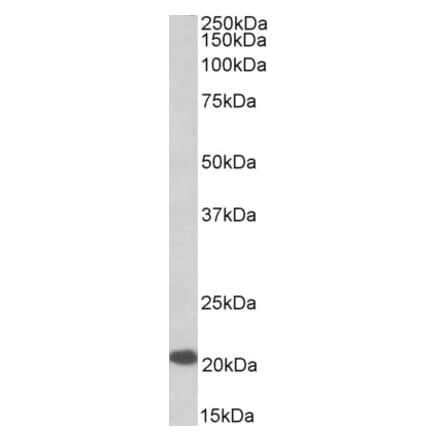 Western Blot - Anti-CSP Antibody (A85084) - Antibodies.com