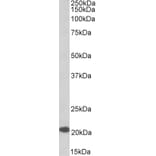 Western Blot - Anti-CSP Antibody (A85084) - Antibodies.com