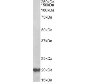 Western Blot - Anti-CSP Antibody (A85085) - Antibodies.com