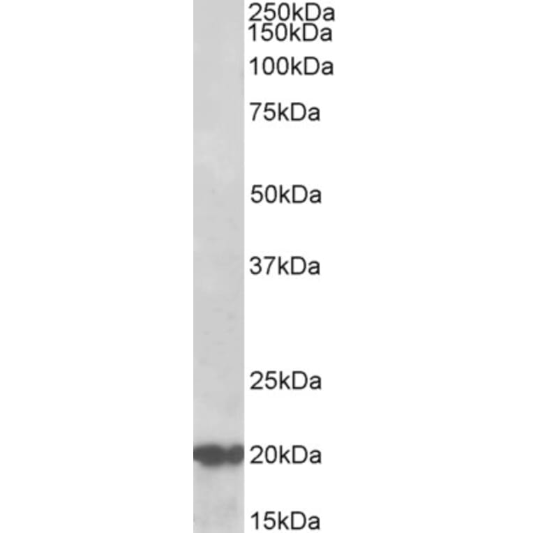 Western Blot - Anti-CSP Antibody (A85085) - Antibodies.com