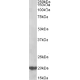 Western Blot - Anti-CSP Antibody (A85085) - Antibodies.com