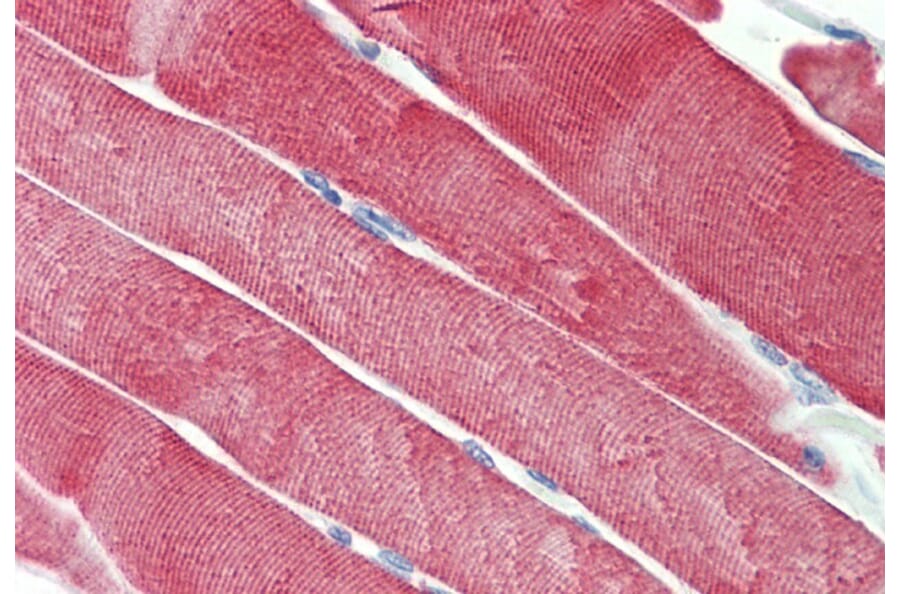 Immunohistochemistry - Anti-CSP Antibody (A85085) - Antibodies.com