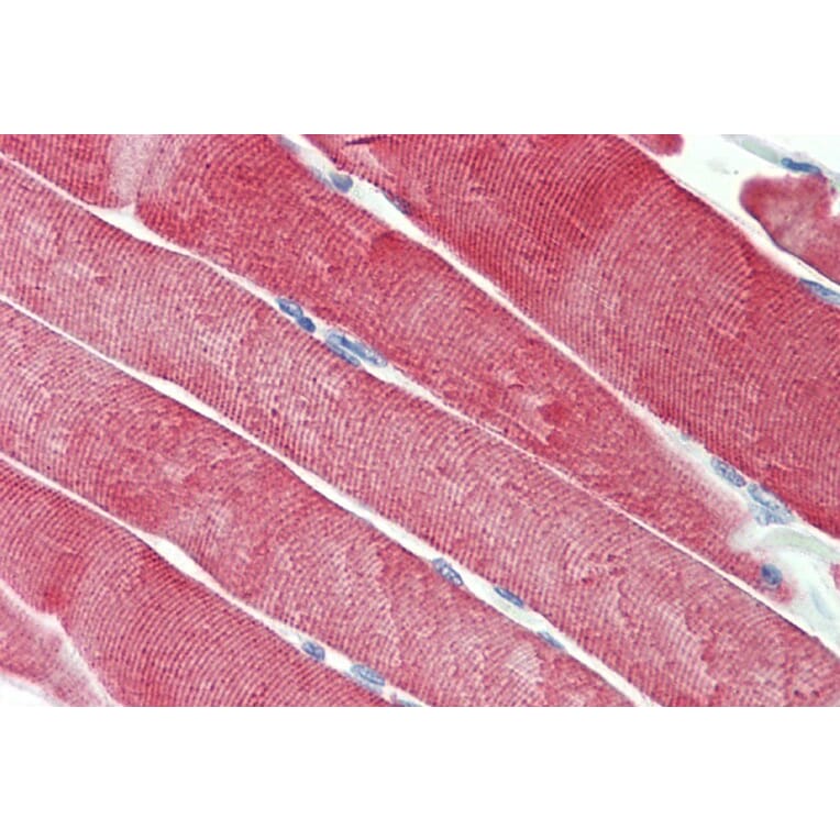 Immunohistochemistry - Anti-CSP Antibody (A85085) - Antibodies.com