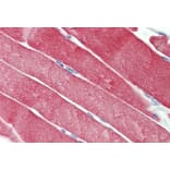 Immunohistochemistry - Anti-CSP Antibody (A85085) - Antibodies.com