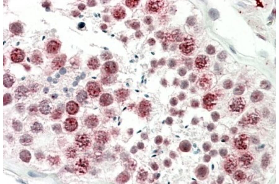 Immunohistochemistry - Anti-DNAJC5G Antibody (A85086) - Antibodies.com