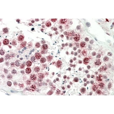 Immunohistochemistry - Anti-DNAJC5G Antibody (A85086) - Antibodies.com