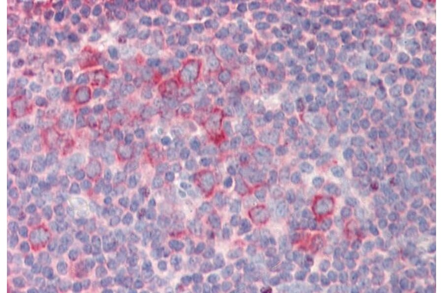 Immunohistochemistry - Anti-RPL23 Antibody (A85087) - Antibodies.com