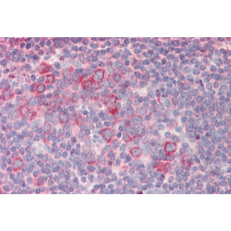 Immunohistochemistry - Anti-RPL23 Antibody (A85087) - Antibodies.com