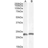 Western Blot - Anti-LIF Antibody (A85090) - Antibodies.com