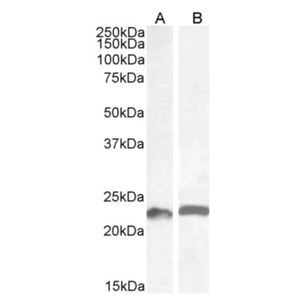Western Blot - Anti-LIF Antibody (A85090) - Antibodies.com