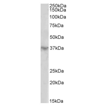 Western Blot - Anti-HOXD12 Antibody (A85093) - Antibodies.com