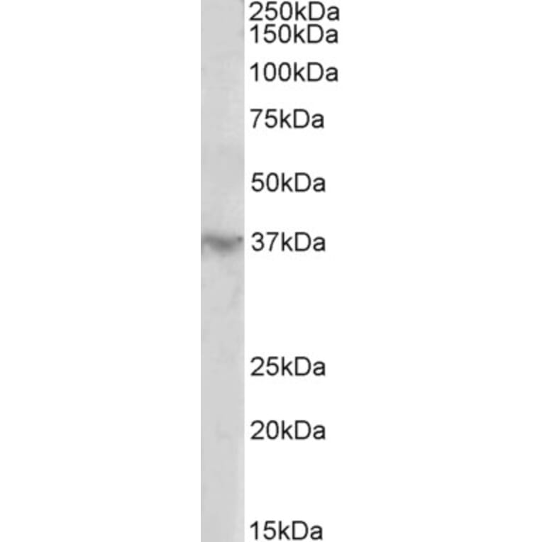 Western Blot - Anti-HOXD12 Antibody (A85093) - Antibodies.com