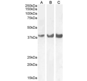 Western Blot - Anti-HOXD13 Antibody (A85094) - Antibodies.com