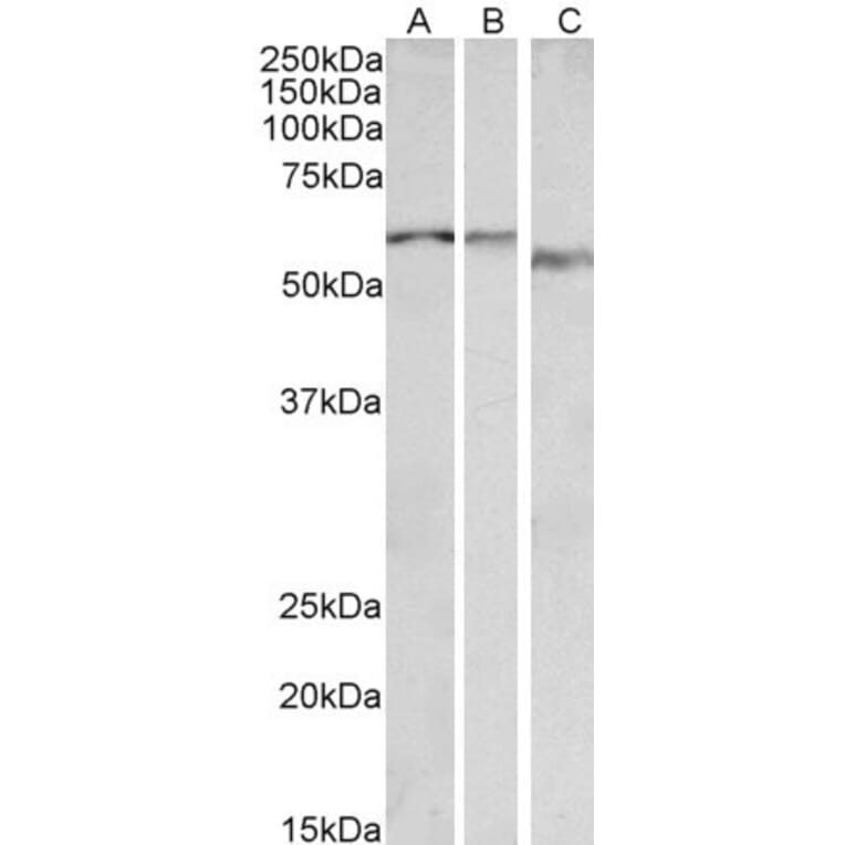 Western Blot - Anti-ADRA1B Antibody (A85095) - Antibodies.com