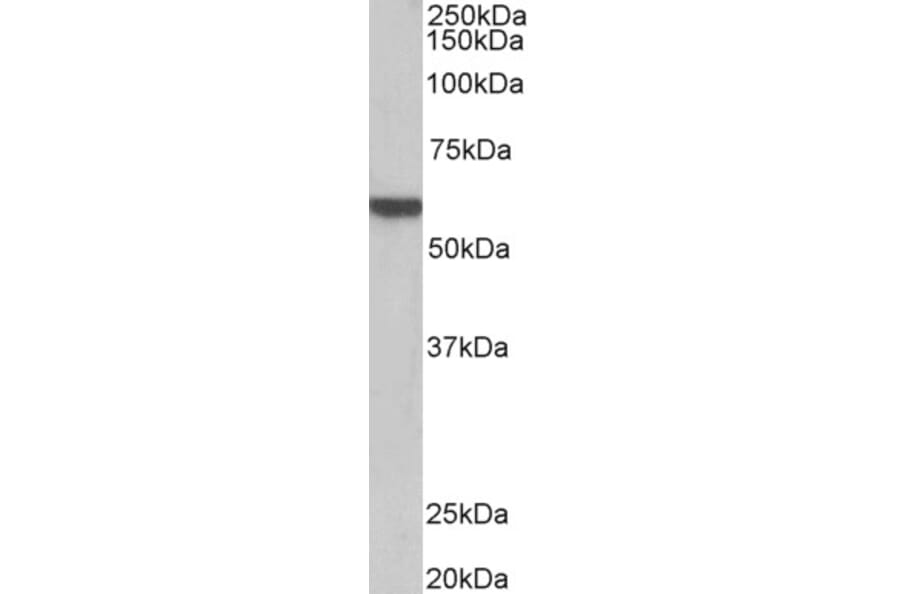 Western Blot - Anti-ADRA1B Antibody (A85095) - Antibodies.com