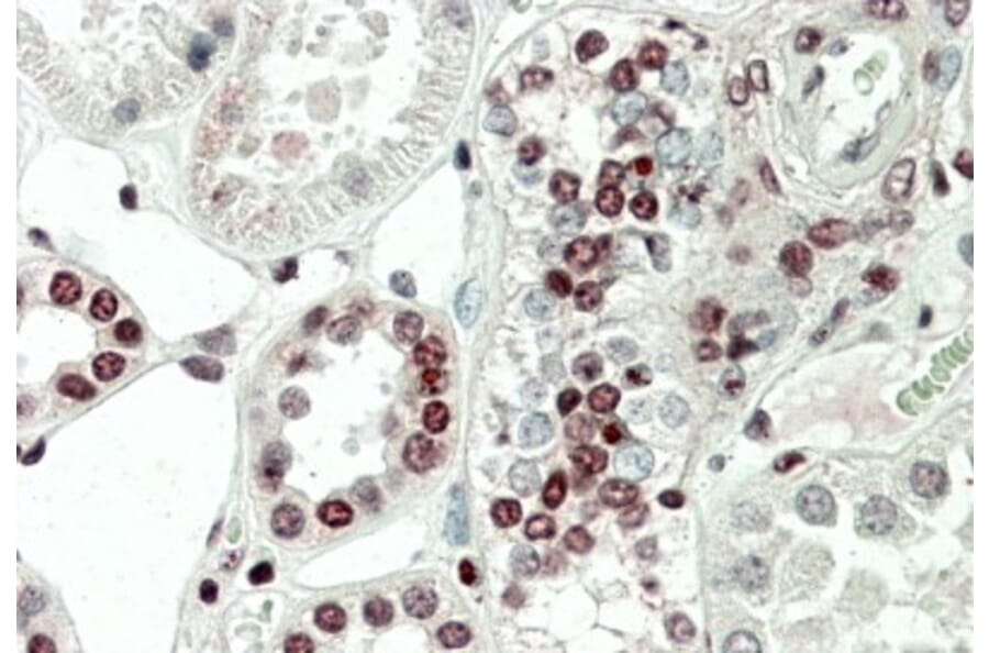 Immunohistochemistry - Anti-PRAK/MK5 Antibody (A85098) - Antibodies.com