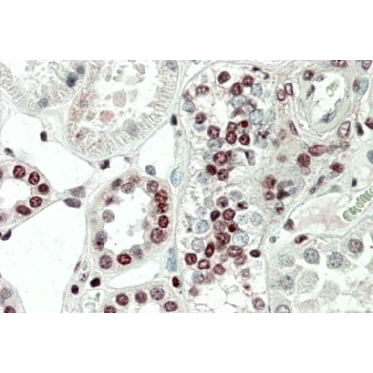 Immunohistochemistry - Anti-PRAK/MK5 Antibody (A85098) - Antibodies.com