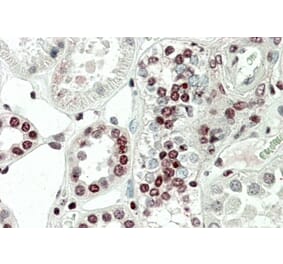 Immunohistochemistry - Anti-Mapkapk5 Antibody (A85098) - Antibodies.com