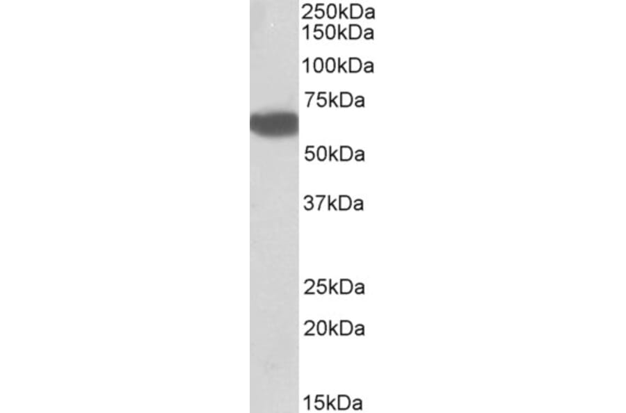 Western Blot - Anti-BTD Antibody (A85099) - Antibodies.com