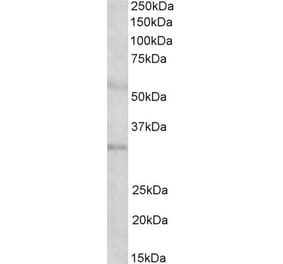 Western Blot - Anti-IGFBP1 Antibody (A85100) - Antibodies.com