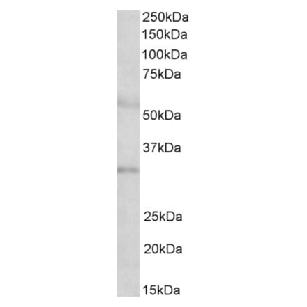 Western Blot - Anti-IGFBP1 Antibody (A85100) - Antibodies.com