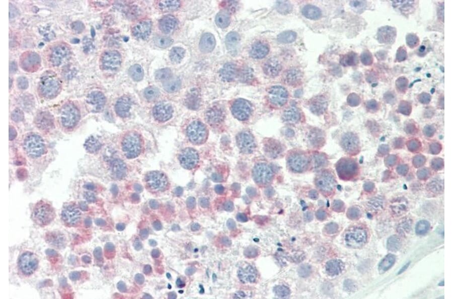 Immunohistochemistry - Anti-IGFBP1 Antibody (A85100) - Antibodies.com