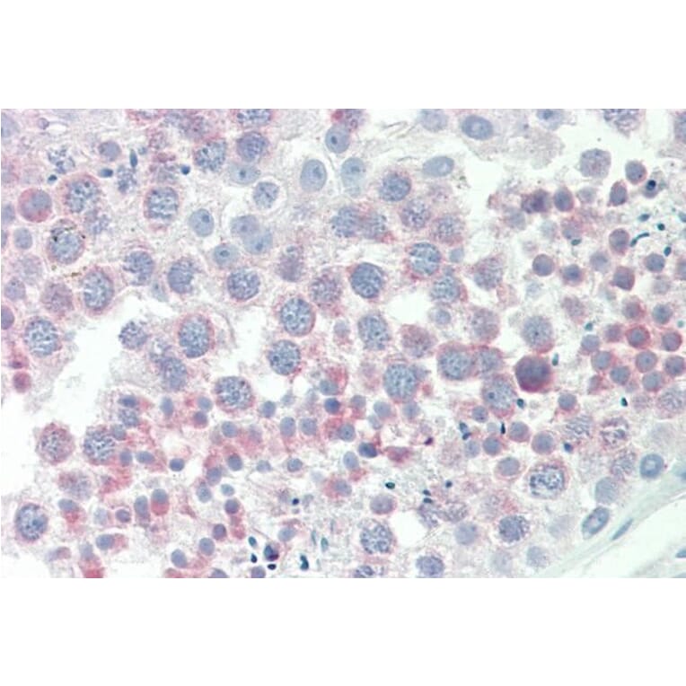 Immunohistochemistry - Anti-IGFBP1 Antibody (A85100) - Antibodies.com
