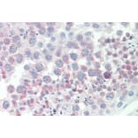 Immunohistochemistry - Anti-IGFBP1 Antibody (A85100) - Antibodies.com