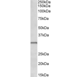 Western Blot - Anti-IGFBP1 Antibody (A85101) - Antibodies.com